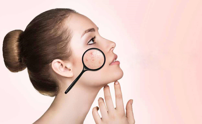 درمان اسکار