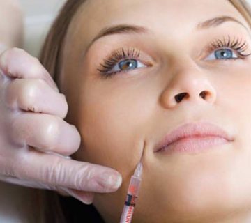 ژل پروفایلو چیست؟