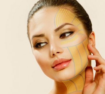 مزایای اصلی هایفو