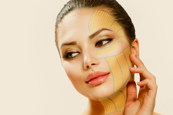 مزایای اصلی هایفو