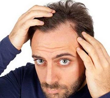 روش های غیر جراحی درمان ریزش مو