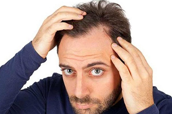 روش های غیر جراحی درمان ریزش مو