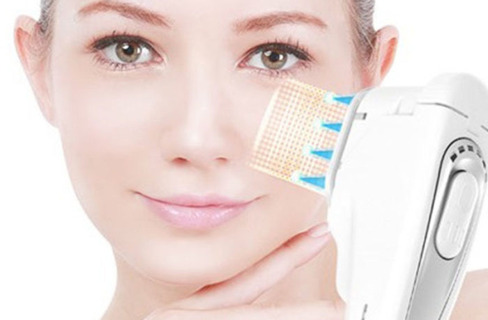 مزایای اصلی هایفو