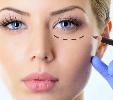 روش های درمان چین و چروک اطراف چشم