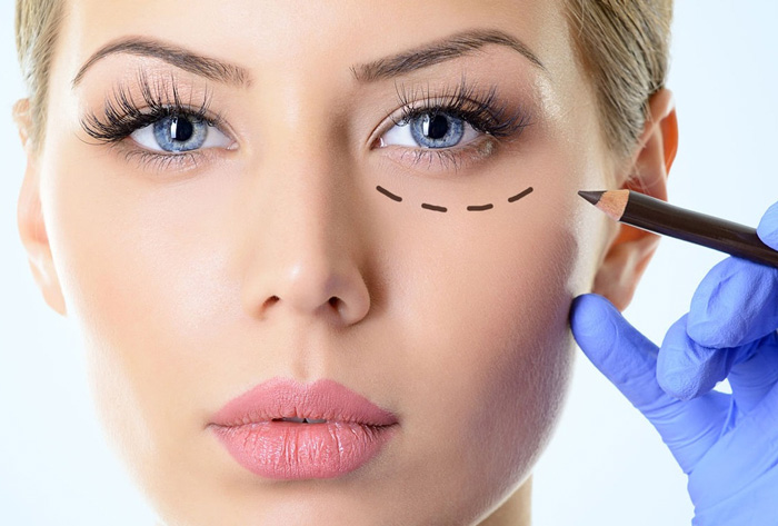 روش های درمان چین و چروک اطراف چشم