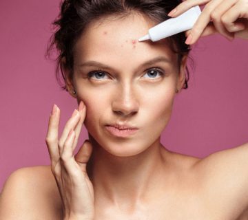 علائم و علت آکنه صورت