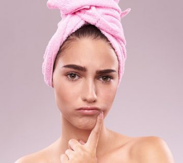 تفاوت آکنه و جوش