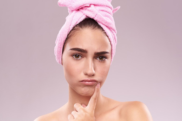 تفاوت آکنه و جوش