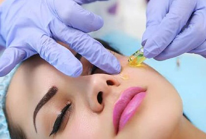 سابسیژن جای آکنه یا اسکار: راهنمایی موثر برای درمان اسکار آکنه