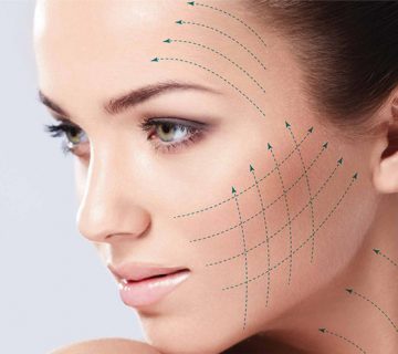 همه چیز درباره ی هایفو