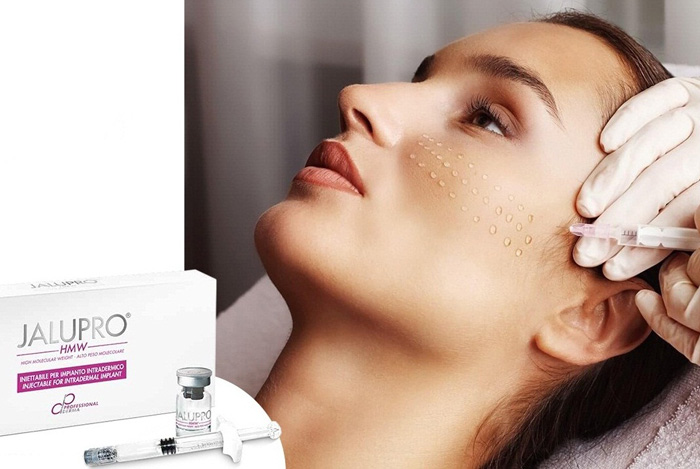 کمی بیشتر در رابطه با جالپرو بدانیم