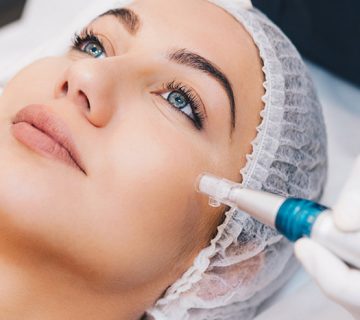 مراقبت های مربوط به میکرونیدلینگ قبل و پس از آن